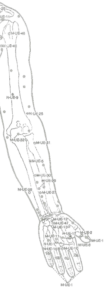 puntos-acupuntura-brazo
